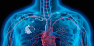 It is important that patients keep any consumer electronic devices such as cell phones, and smart watches, that may create magnetic interference, at least six inches away from implanted medical devices, in particular cardiac defibrillators, warns the FDA.